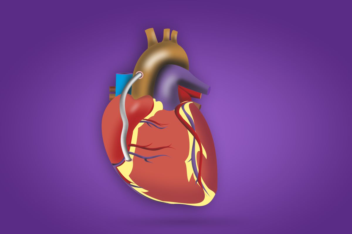 aorta-illustration