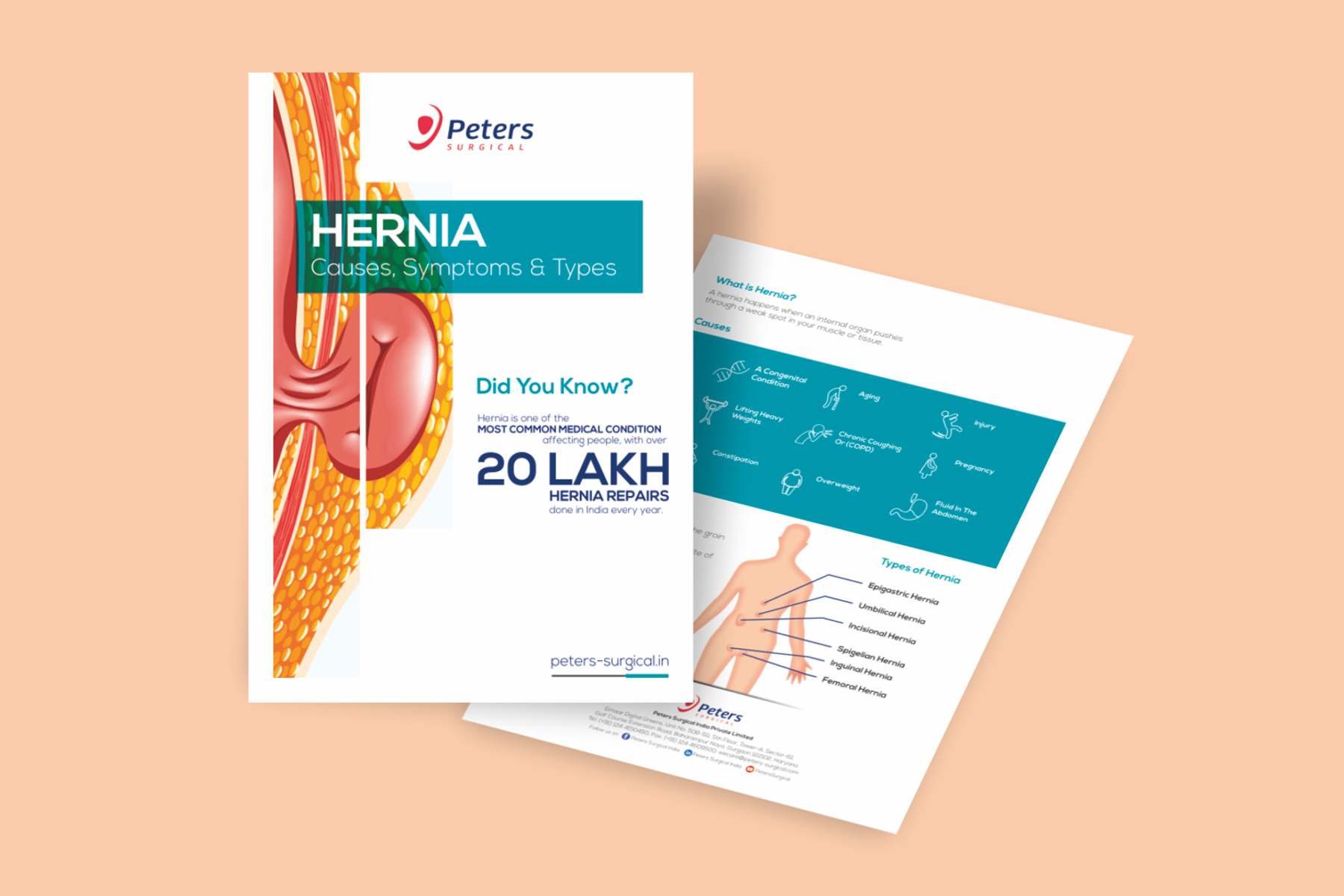 hernia-leaflet-mockup